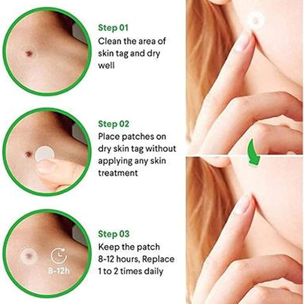 The Shield | Premium Hydrocolloid Acne & Skin Tag Healing Patches (108 Dots Value Pack)