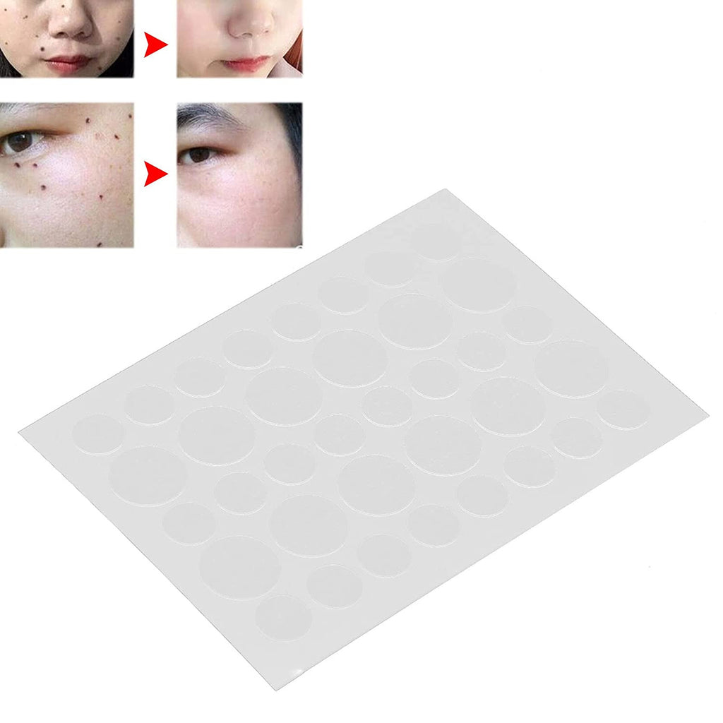 The Shield | Premium Hydrocolloid Acne & Skin Tag Healing Patches (108 Dots Value Pack)